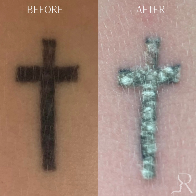 090826B8-46D8-4152-A9A4-1645A9759E04_1_105_c