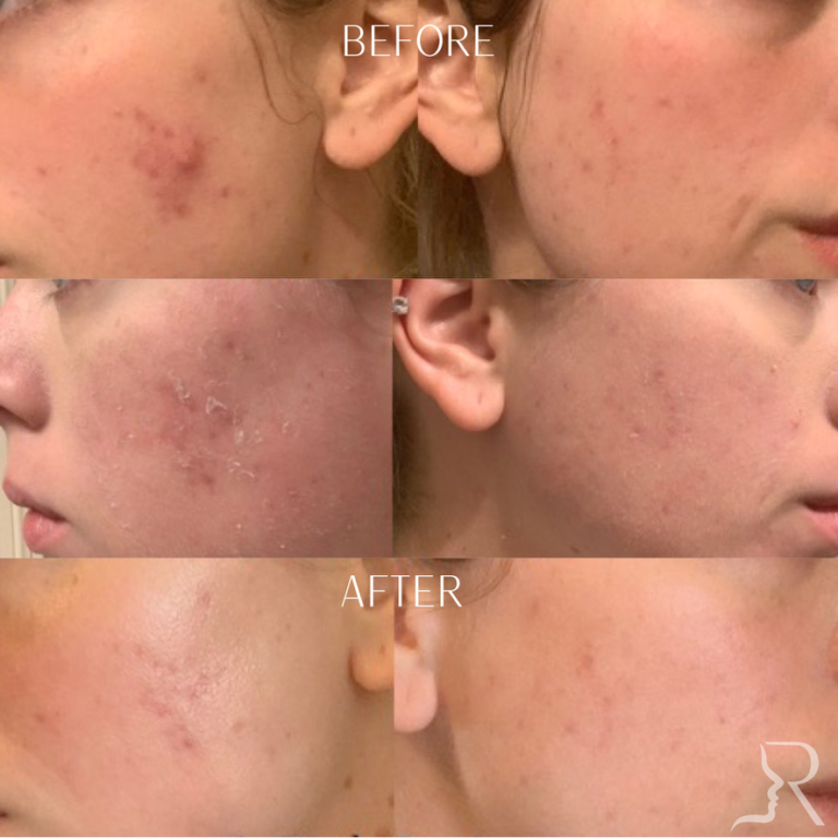 17A57E1B-CE9E-4139-8A00-306130D8751C_1_105_c