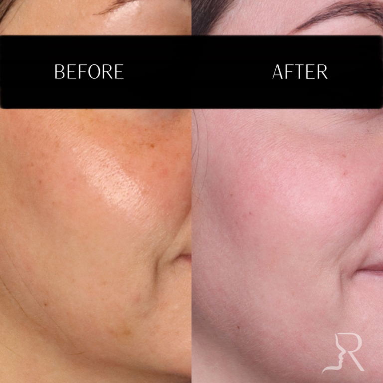 20173C00-D82A-44D7-A583-AAD43240143F_1_105_c