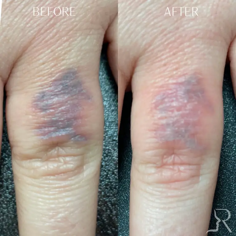 2496000D-07EB-4CA9-9F39-BFDDE902BF69_1_105_c