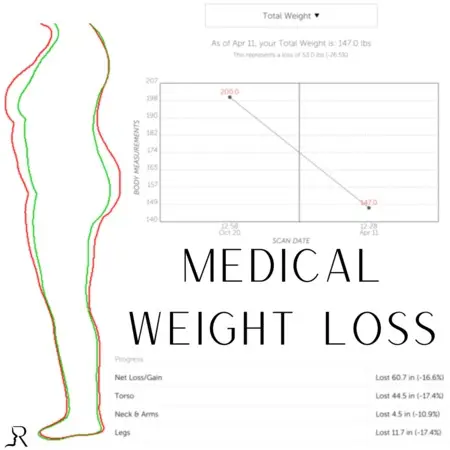 35D977BA-67FB-4AF0-A462-4BA2B29394CF_1_102_o