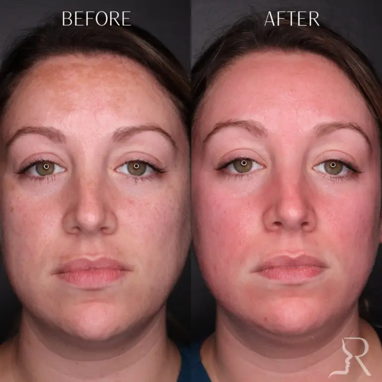 38307392-859A-418E-9B79-EB432F3C4385_1_105_c