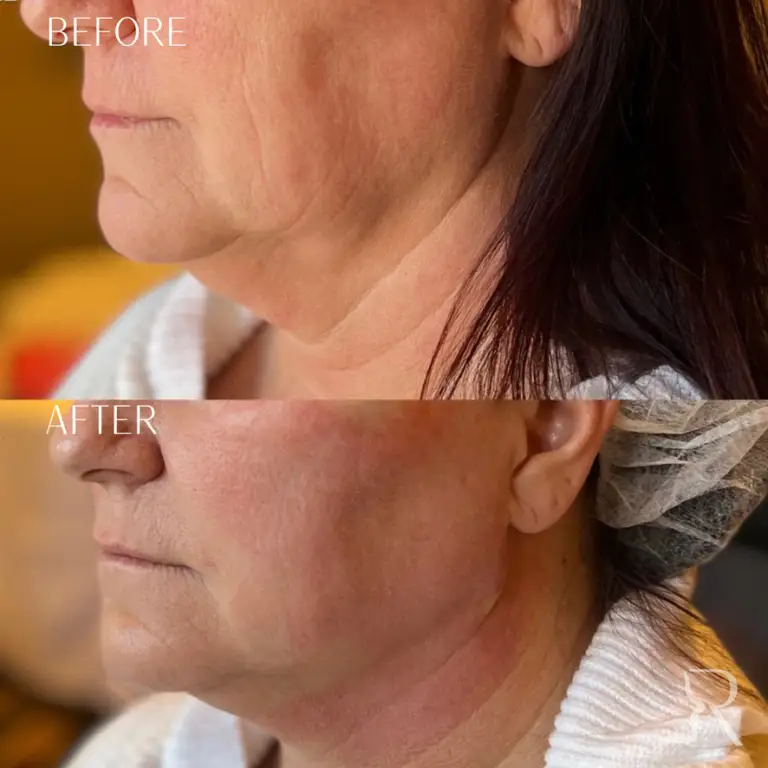 451017D8-D7B9-42CC-9EEC-CB32898EECAF_1_105_c