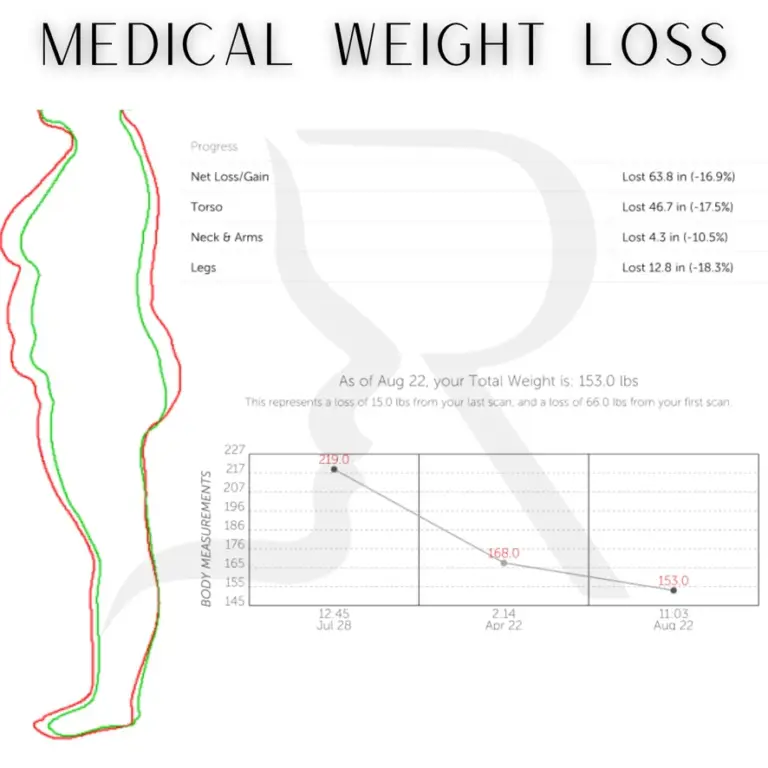 Medical Weight Loss - 2