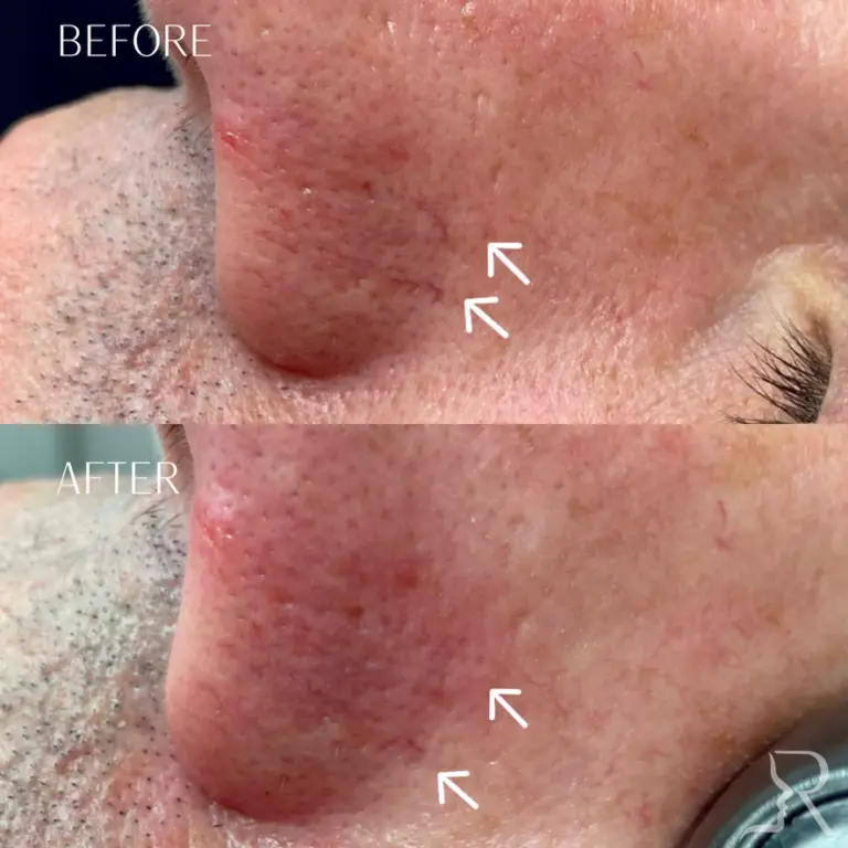 83C9464F-2D67-467C-A19C-218844599258_1_105_c