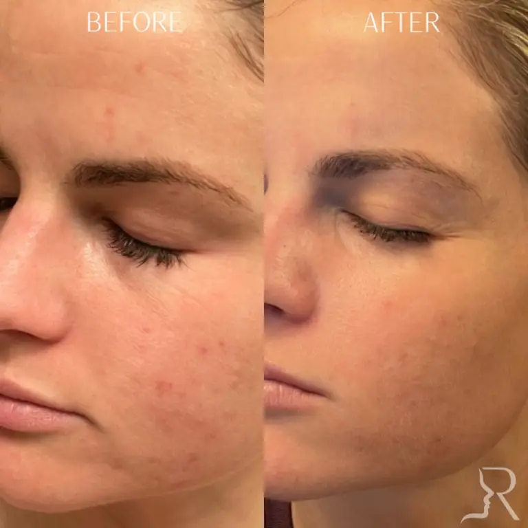 899A6134-25A6-4B62-AEEE-8D7F5ABDA679_1_105_c