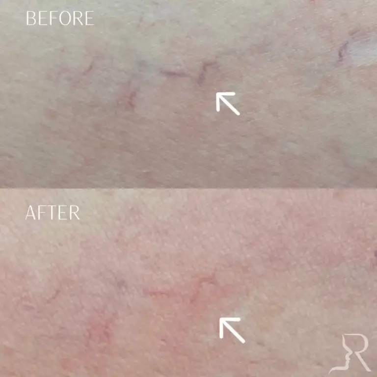 9B8057D8-8286-4661-9187-86494C99EB1A_1_105_c