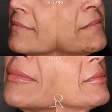 9D0934E9-457A-481D-888F-B81F72AF3184_4_5005_c