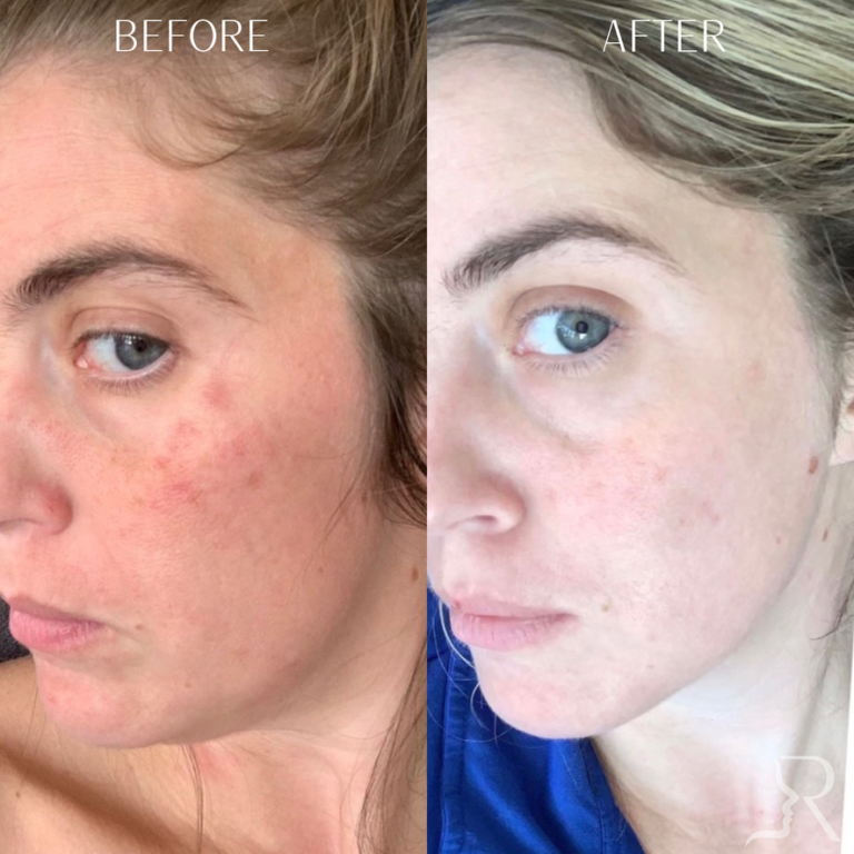 BAC202C1-266B-4C7D-9AF4-4335DCC61BAD_1_105_c