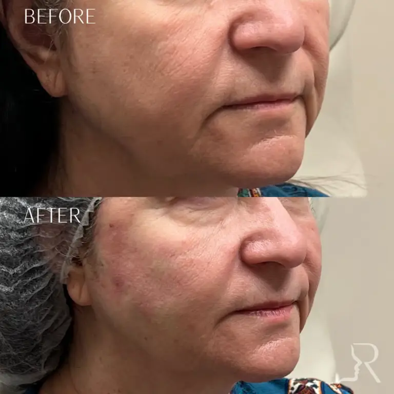 BBA5C620-5DC4-47E8-9836-B448E33E4787_1_105_c