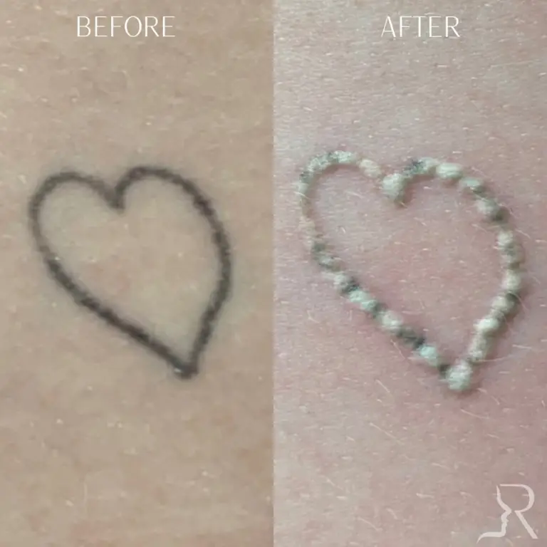 C8B3EB8F-3024-472A-985D-0C7DD5C3482A_1_105_c