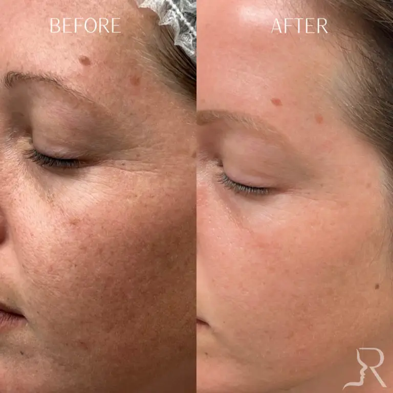 CE3BCBFF-D302-43E1-88B6-E705F2684EFB_1_105_c