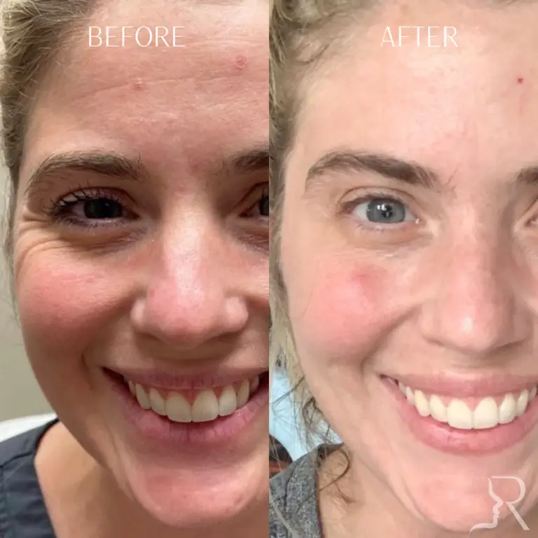 D0C6C9A9-4438-4112-ABE3-9D0587CC2A98_1_105_c