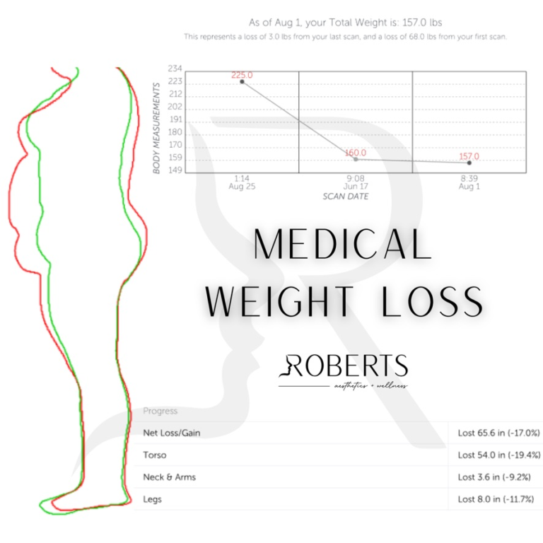 Medical Weight Loss - 1