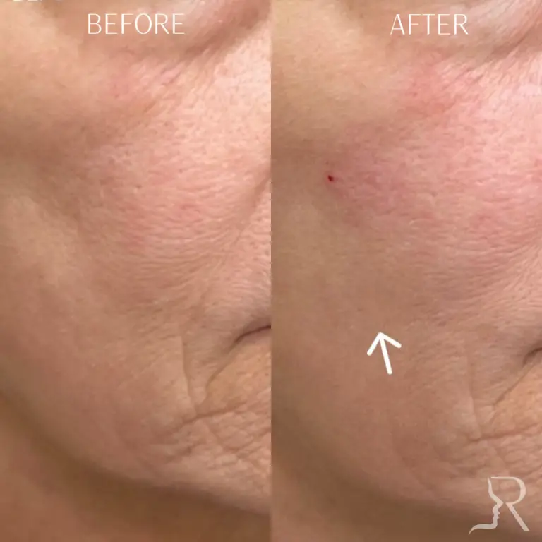 E9AE15B9-89CE-4AC9-87FC-0A8BB8CA59C5_1_105_c