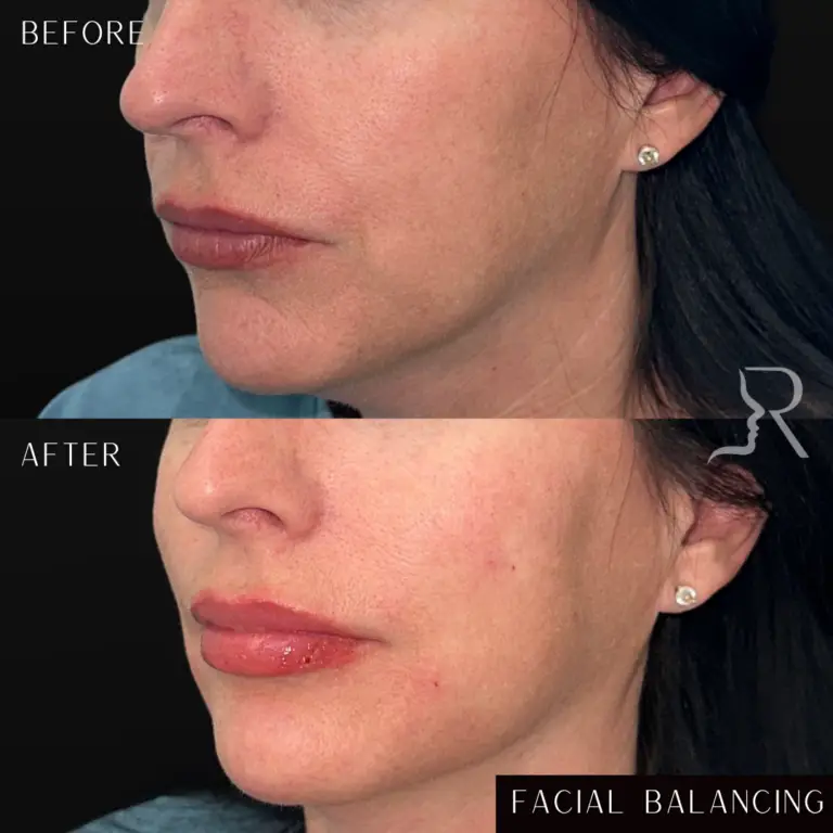 before & after 5 - 1